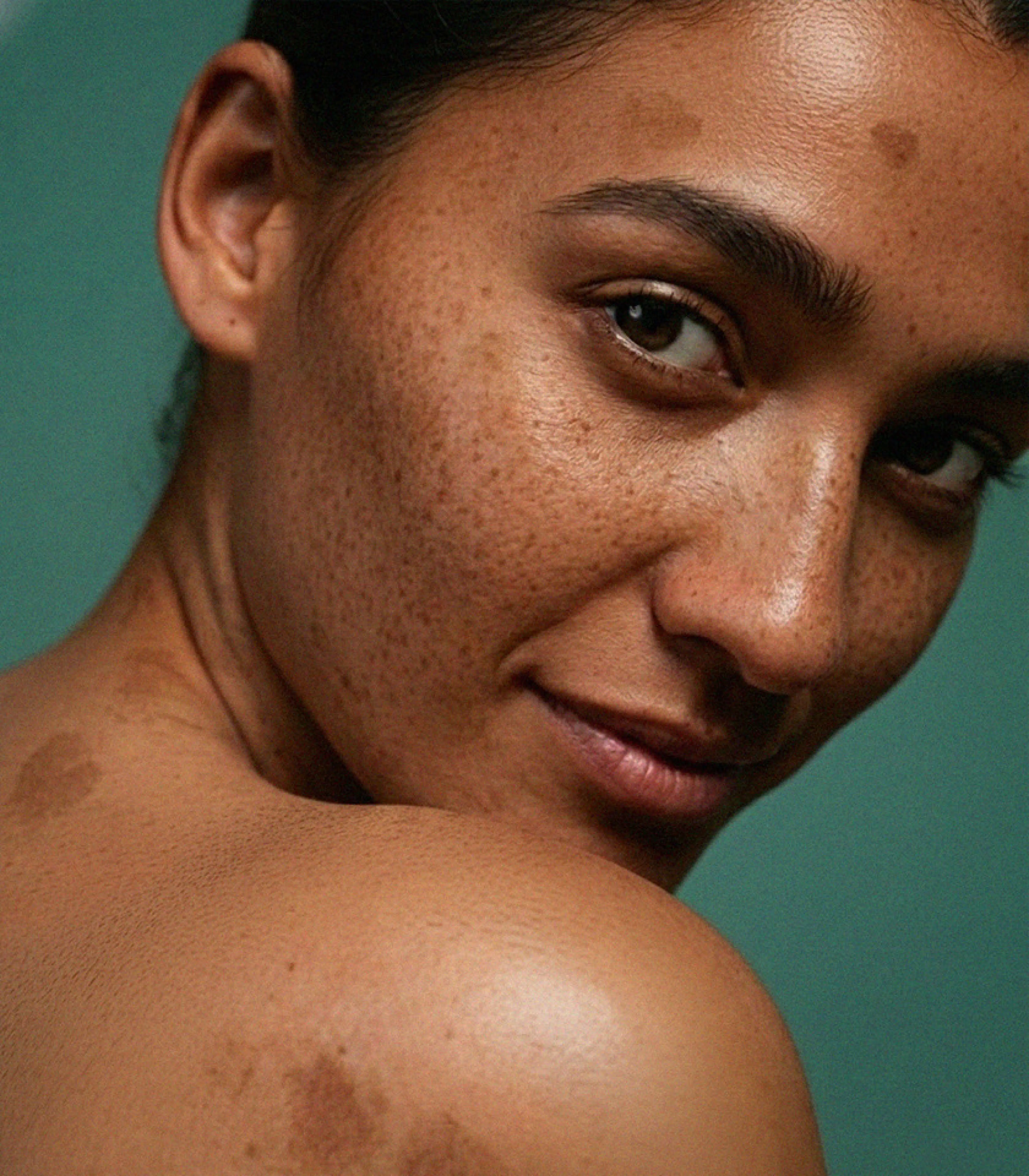 Pigmentation and dark spots treatment